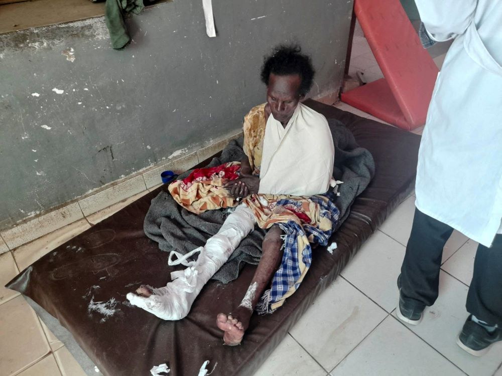A survivor of an airstrike by Ethiopian government forces receives treatment at the Shire Shul General Hospital in the northern region of Tigray, Ethiopia, Jan. 8. (CNS/Reuters)