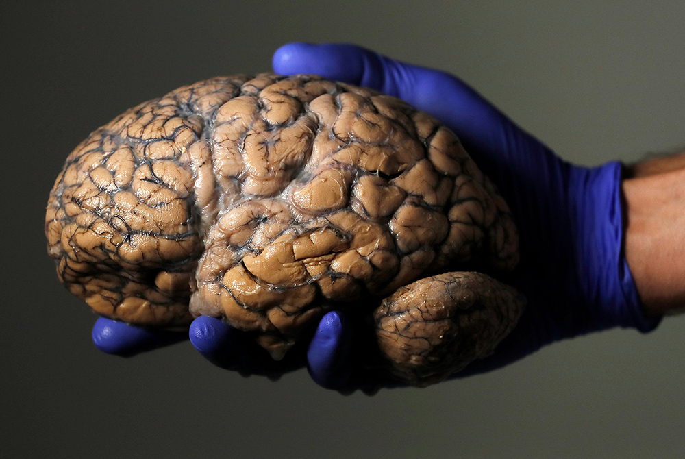 A Belgian researcher holds a human brain as part of a study into psychiatric diseases July 19, 2017. (CNS/Reuters/Yves Herman)