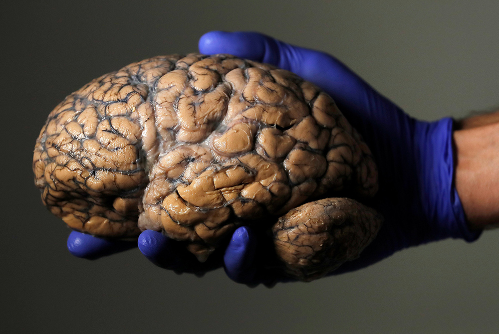 A Belgian researcher holds a human brain as part of a study into psychiatric diseases July 19, 2017. (CNS/Reuters/Yves Herman) A Belgian researcher holds a human brain as part of a study into psychiatric diseases July 19, 2017. (CNS/Reuters/Yves Herman)