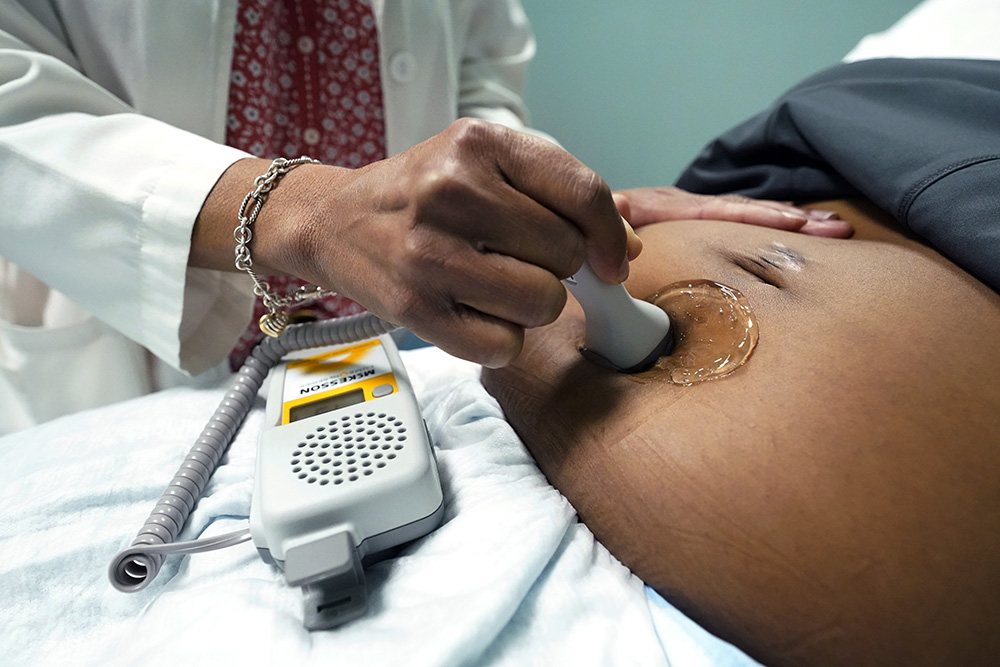 A doctor uses a hand-held Doppler probe on a pregnant woman to measure the heartbeat of the fetus, Dec. 17, 2021, in Jackson, Mississippi. (AP/Rogelio V. Solis, File)