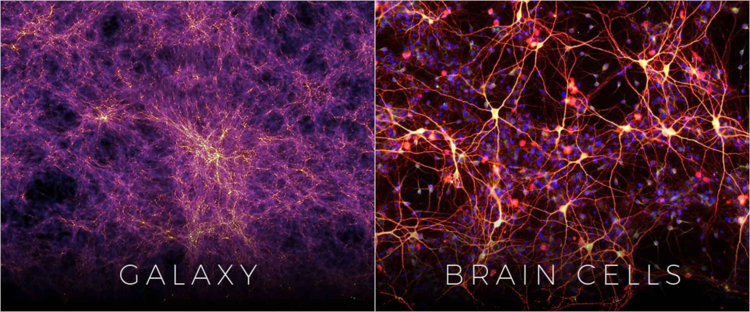 Galaxy - brain cells
