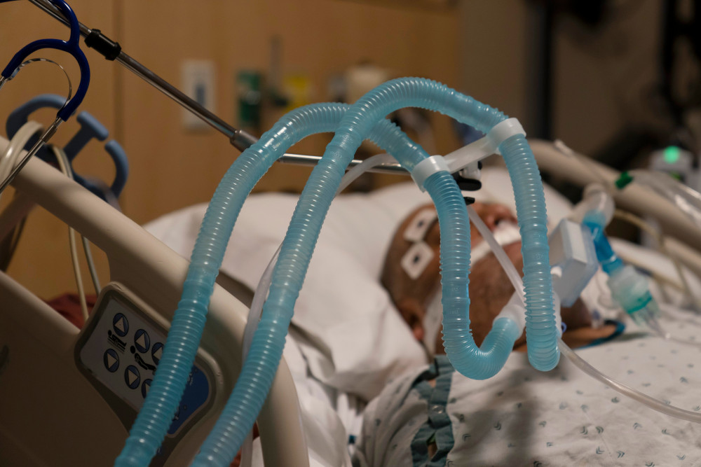 Ventilator tubes are attached to a COVID-19 patient at Providence Holy Cross Medical Center in the Mission Hills section of Los Angeles Nov. 19. (AP/Jae C. Hong)