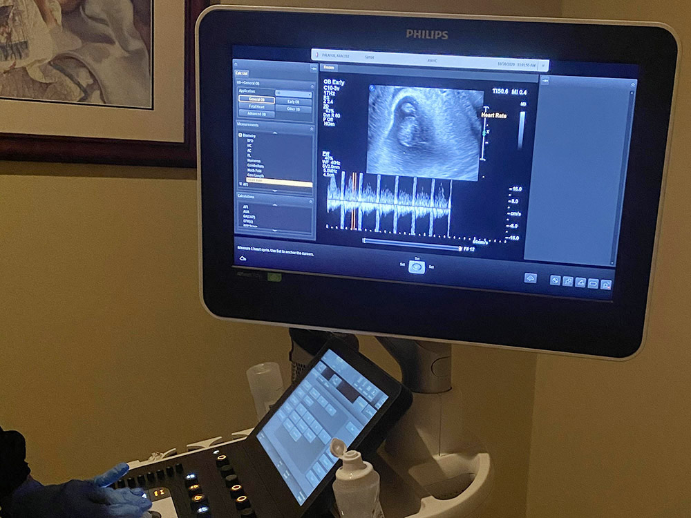 Araceli Palafox attends her first ultrasound appointment alone while her husband waits in the parking lot, in Coachella Valley, California in November 2020. (Courtesy of Araceli Palafox)