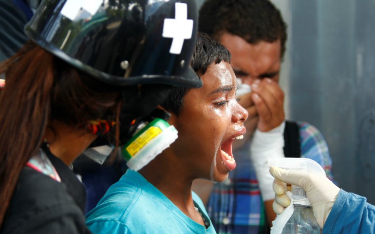 A child receives medical attention after being affected by tear gas during clashes at a July 9 protest against Venezuelan President Nicolas Maduro's government in Caracas. (CNS photo/Christian Veron, Reuters)