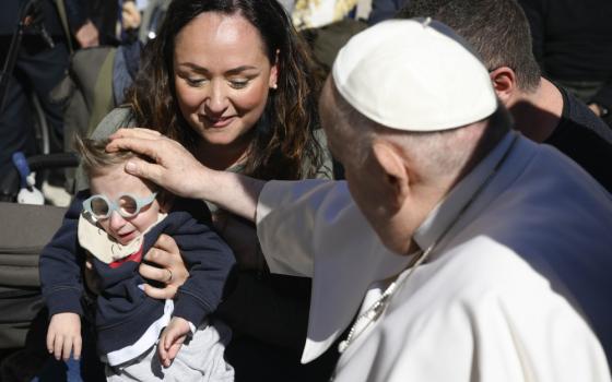 Pope Francis places his hand on a small child's head. The child has blue glasses and is held by a woman.